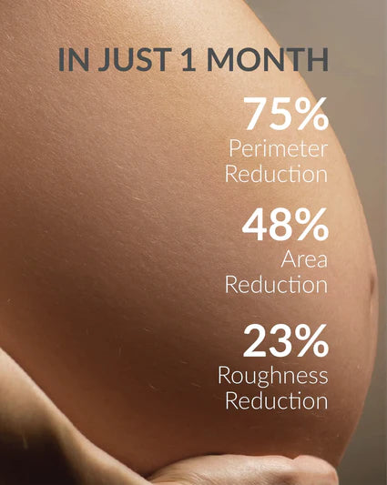 Anti-Stretch Marks Cream